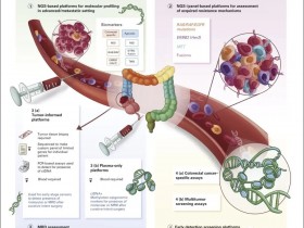 ctDNA在结直肠癌中的临床应用！