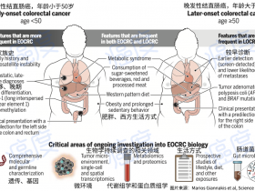 顶级杂志《Science》报道:年轻的结直肠癌患者在全世界迅速增加