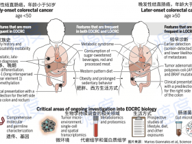 顶级杂志《Science》报道：年轻的结直肠癌患者在全世界迅速增加