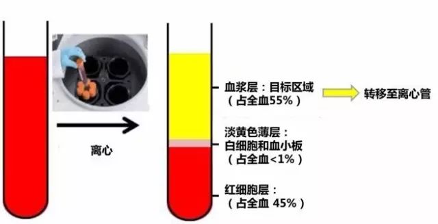 T790M基因突变检测标准流程（血液版）