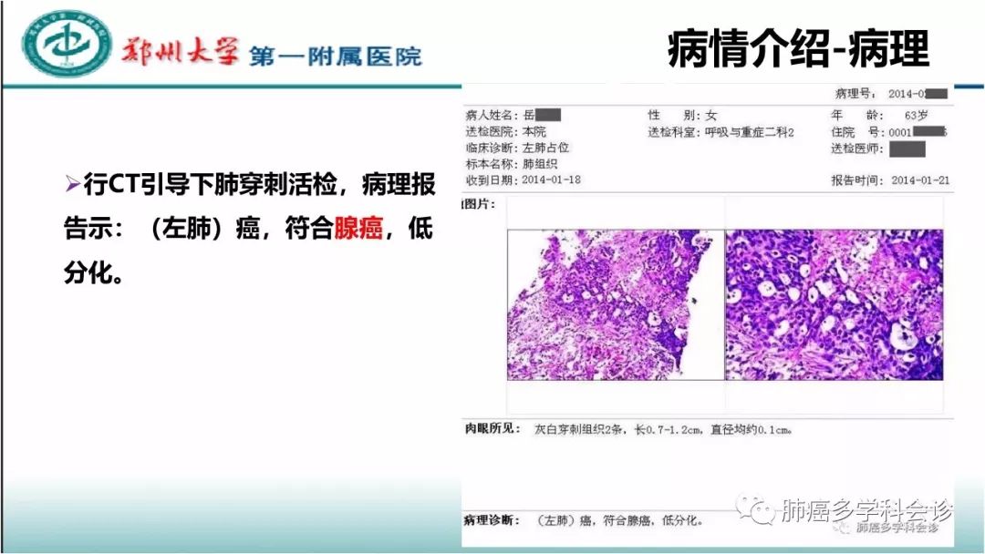 基因突变检测