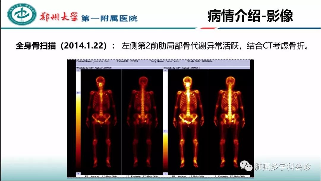 基因突变检测