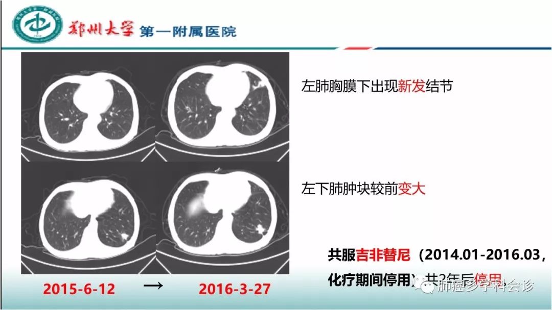 基因突变检测