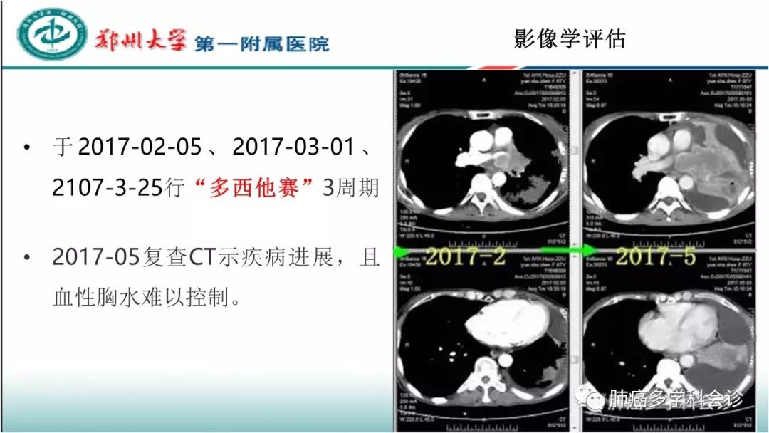 基因突变检测