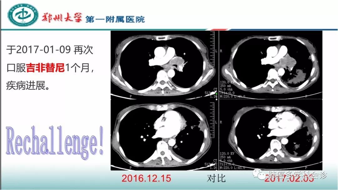 基因突变检测