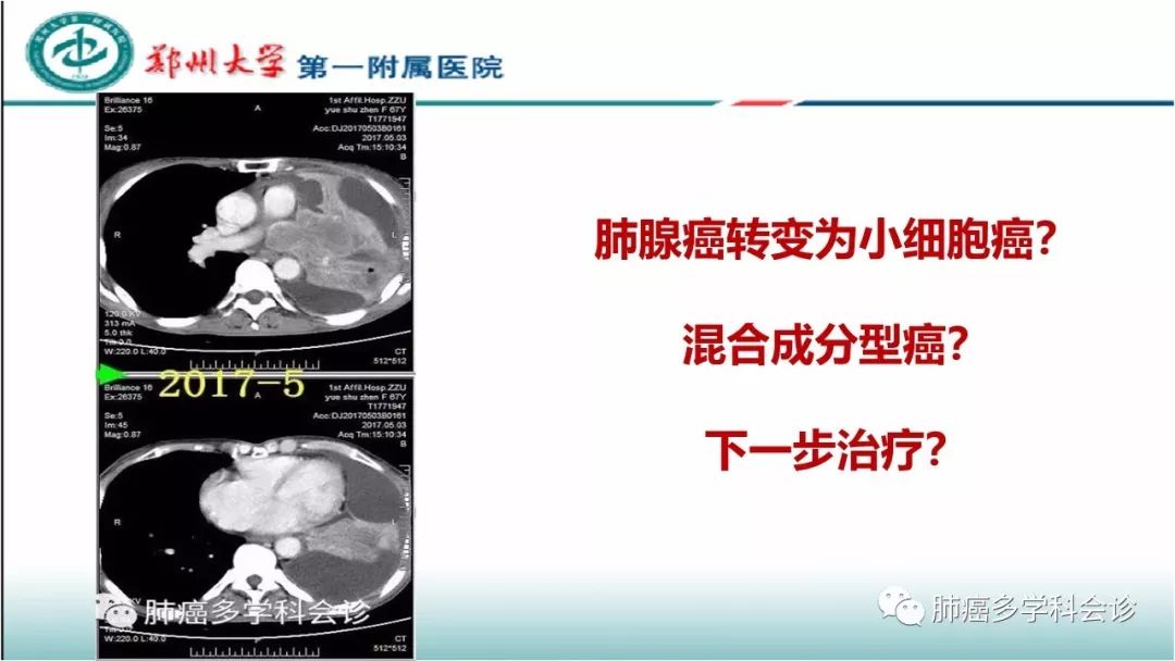 基因突变检测