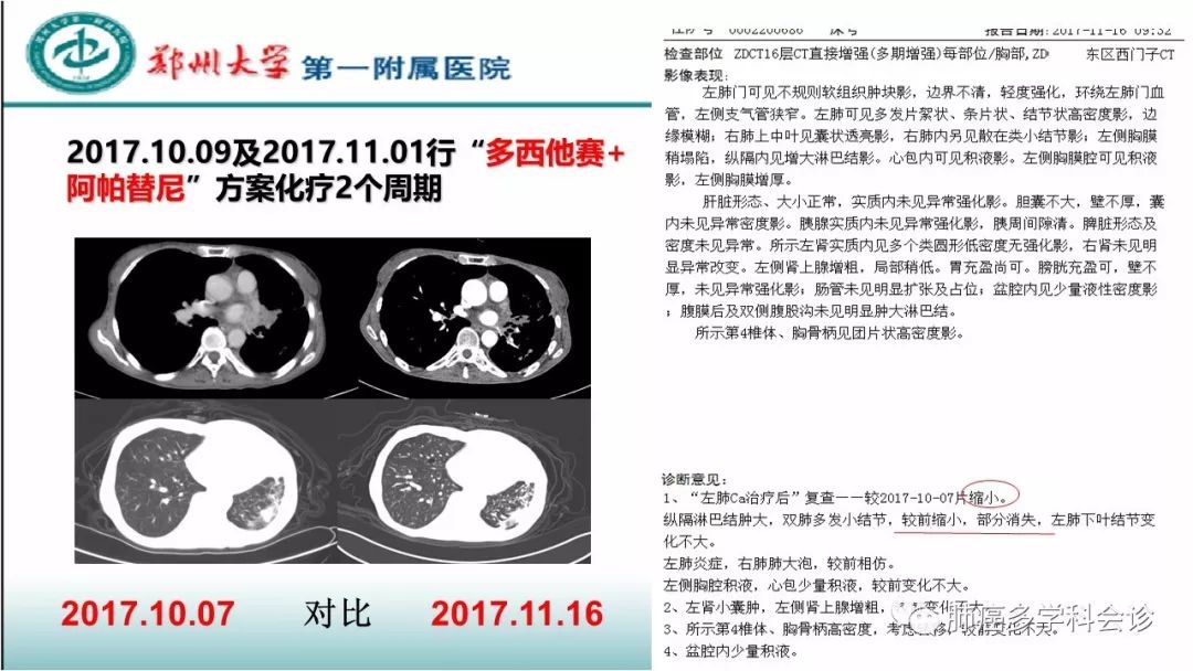 基因突变检测