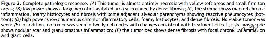 肺癌新辅助治疗后如何评估病理结果？—IASLC的11大建议（下）