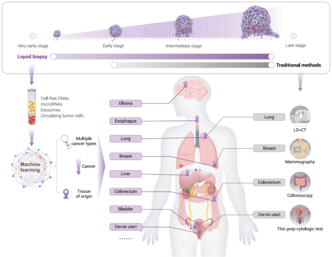 基于cfDNA的液体活检在癌症早检中的进展